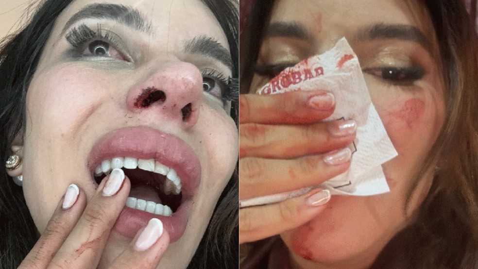 Influenciadora denuncia agressão por transfobia em bar no Maranhão — Foto: Reprodução/Redes Sociais