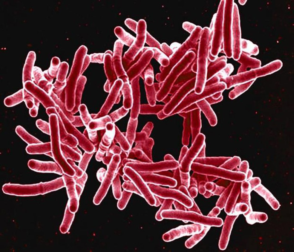   Imagem de microscopia eletrônica  mostra a bactéria Mycobacterium tuberculosis, que provocam tuberculose  — Foto: National Institute of Allergy and Infectious Diseases (NIAID)