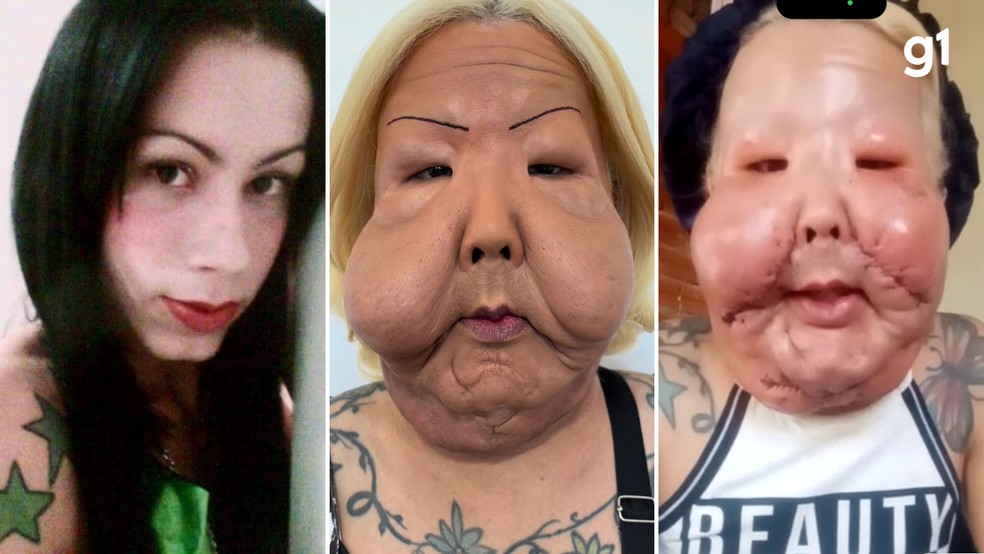 Juliana já planeja nova cirurgia — Foto: Arquivo pessoal