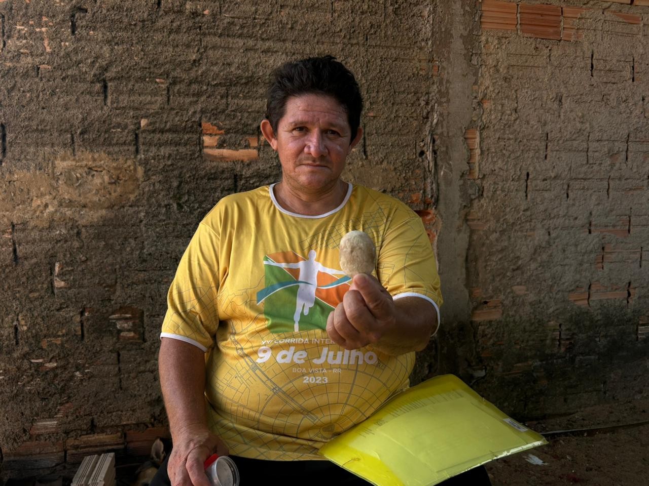 Agricultor retira pedra de 5 cm do rim após 4 anos com dor em RR: 'sem entender como aguentei'