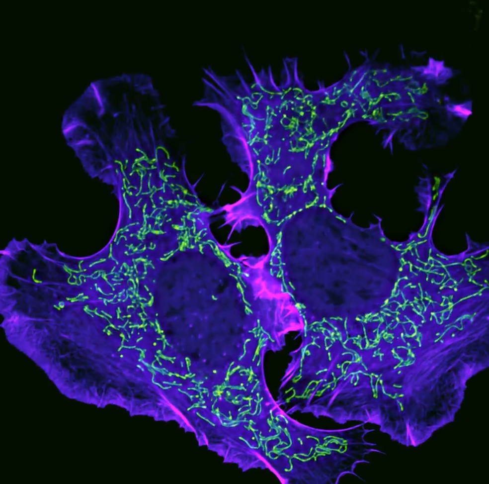 Movimento de actina e mitocôndrias em células de tumor cerebral de camundongo garantiu ao americano Eric Vitriol o 3º lugar na Small World in Motion 2025. — Foto: Eric Vitriol/2025 Small World in Motion Competition/Cortesia