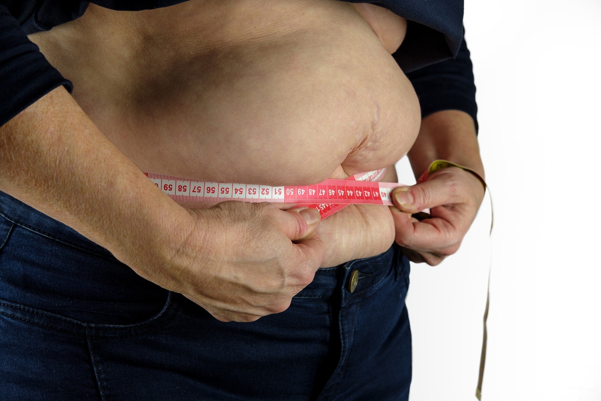 Obesidade deixa de ser apenas fator de risco: 5 sociedades médicas propõem tratamento como doença crônica