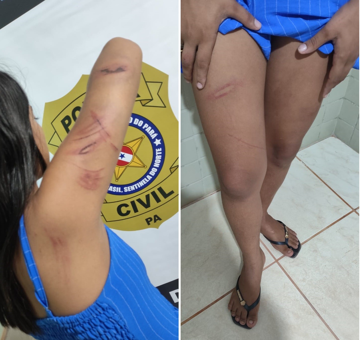 Jovem é sequestrada e torturada por facção criminosa após ameaçar denunciar tráfico no Pará