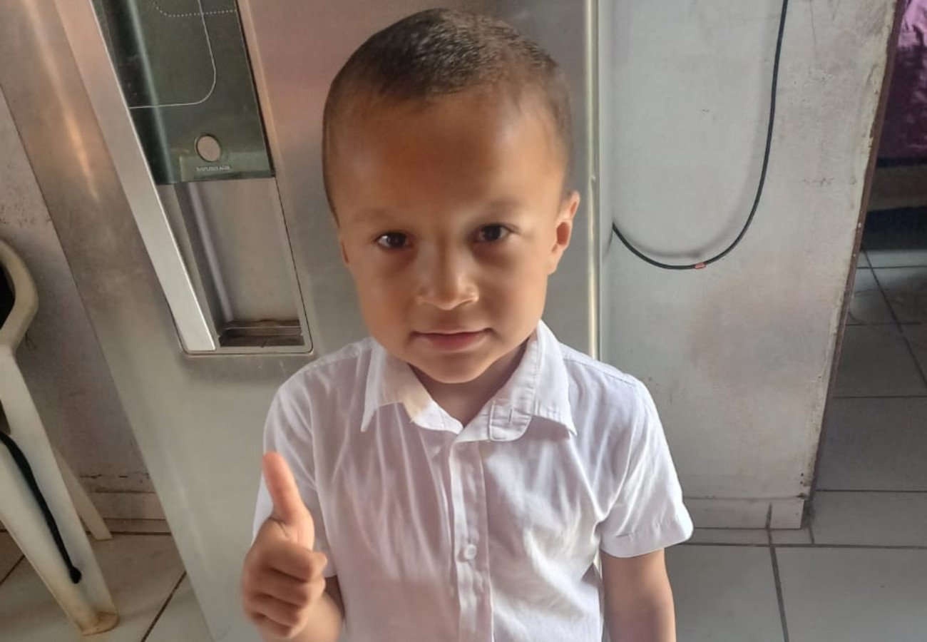 Menino de 5 anos é internado com queimaduras no rosto e no corpo após explosão de churrasqueira na casa do vizinho; VÍDEO