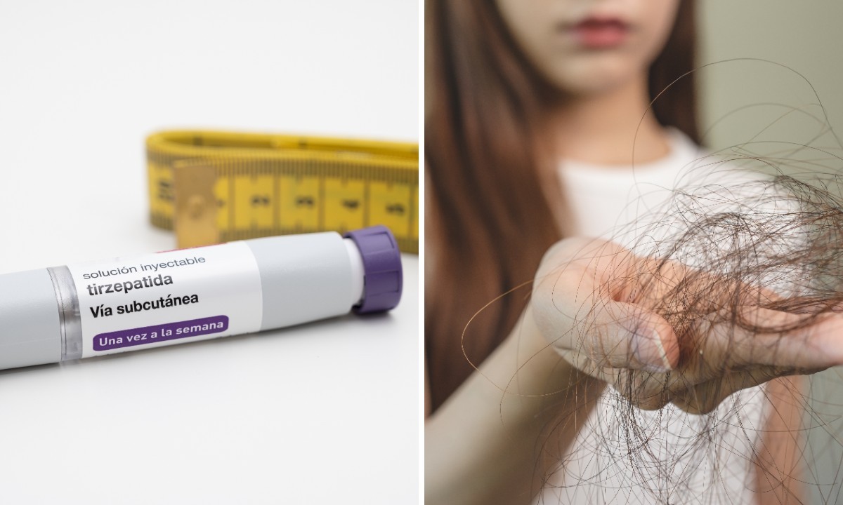Cover image for Queda de cabelo com Mounjaro: estudo explica por que ocorre