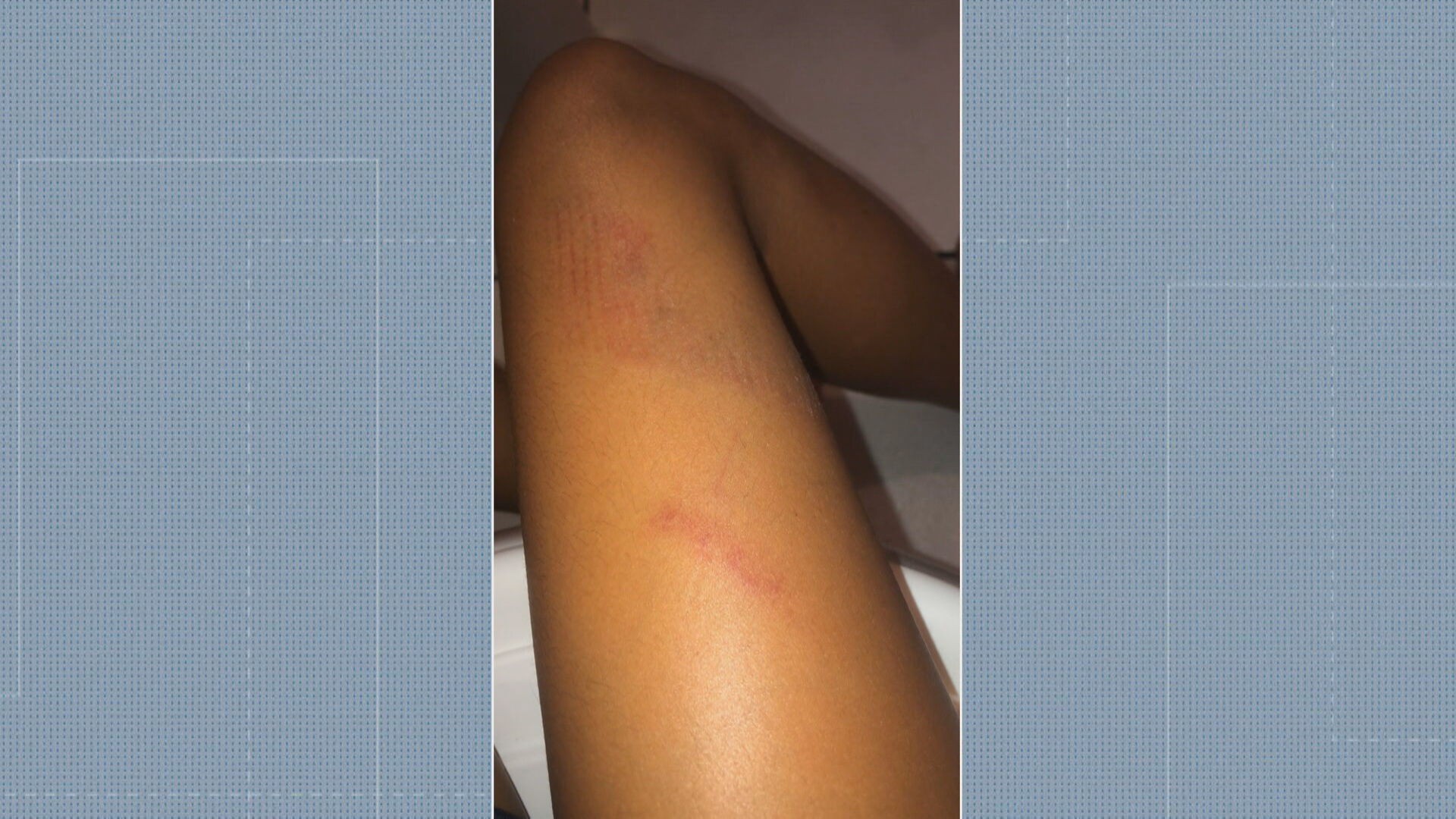 Aluna de 12 anos é agredida por colega dentro de banheiro de escola municipal em Bangu, Zona Oeste do Rio