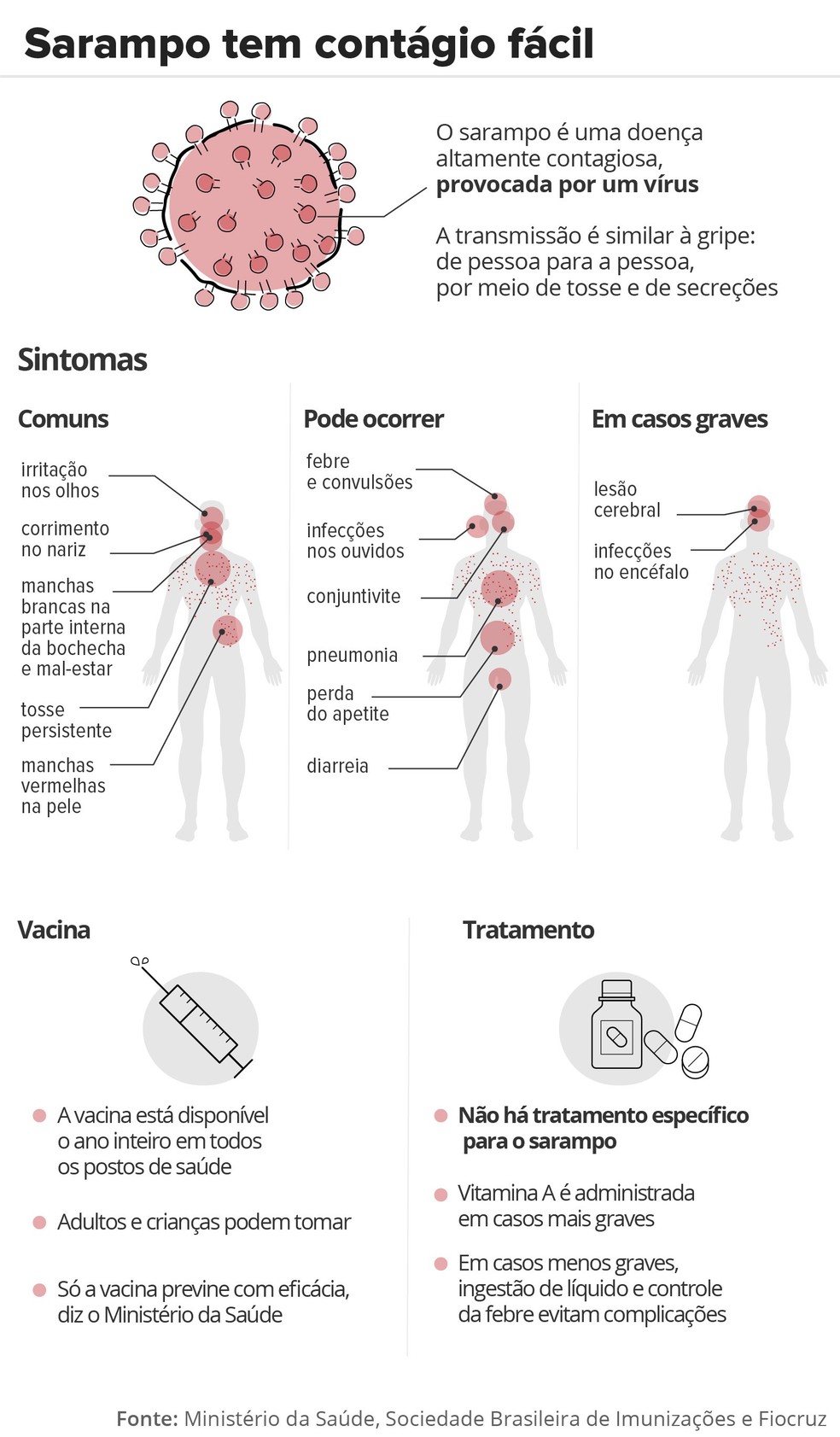 Entenda o que é sarampo, quais os sintomas, como é o tratamento e quem deve se vacinar  — Foto: Infografia: Karina Almeida/G1