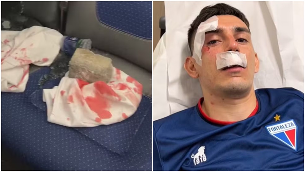 Gonzalo Escobar, do Fortaleza, foi um dos feridos em ataque de torcedores do Sport — Foto: Montagem/g1
