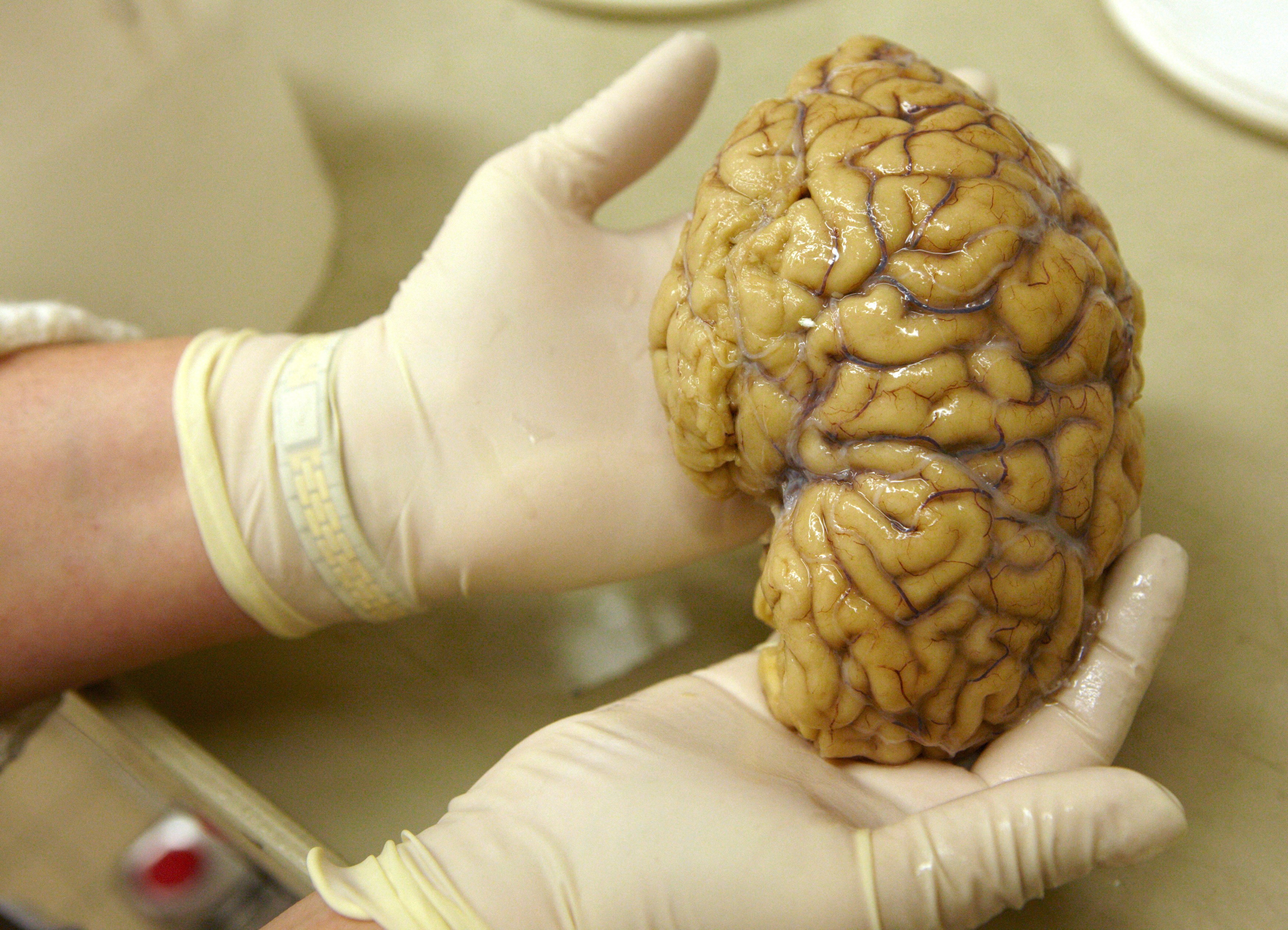 Cientistas mapeiam atividade gênica no córtex pré-frontal do cérebro