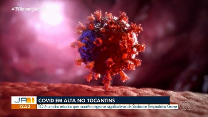 Tocantins registra aumento de casos de síndrome respiratória grave