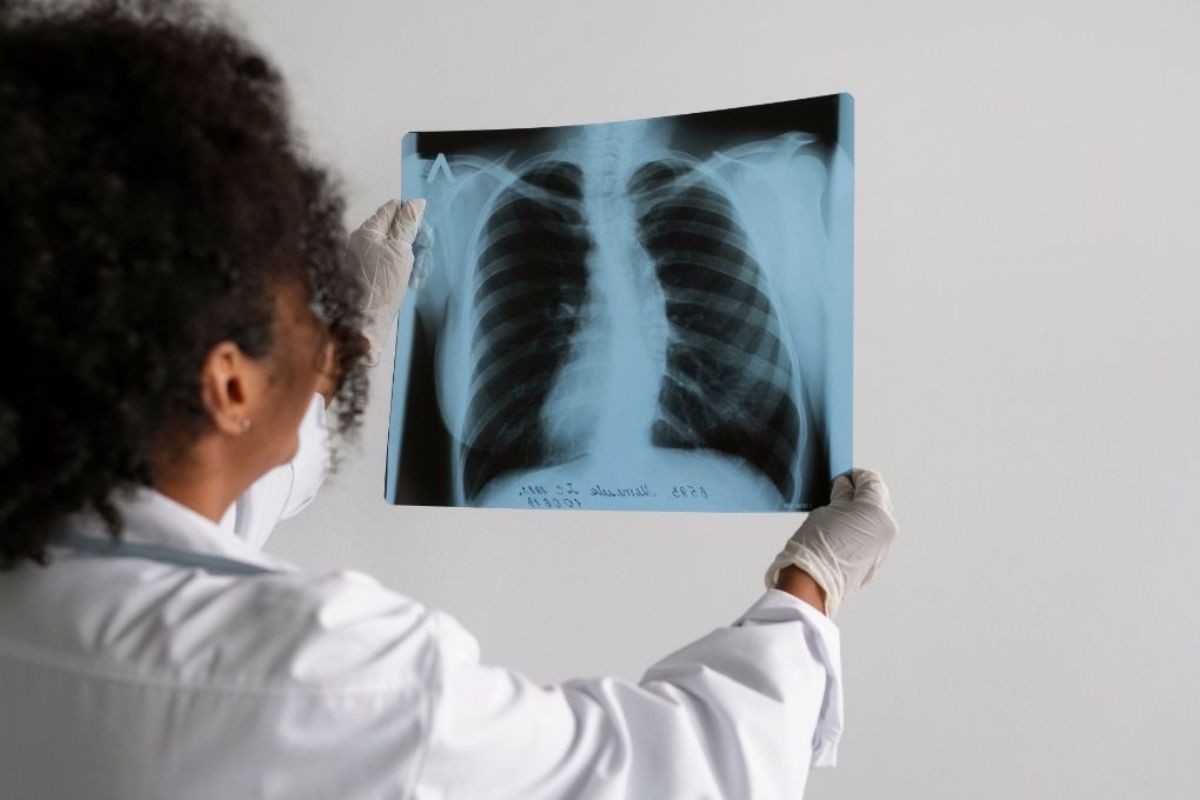 São Vicente, SP, fecha o Centro de Tuberculose e passa atendimento para UBSs e ESFs; entenda