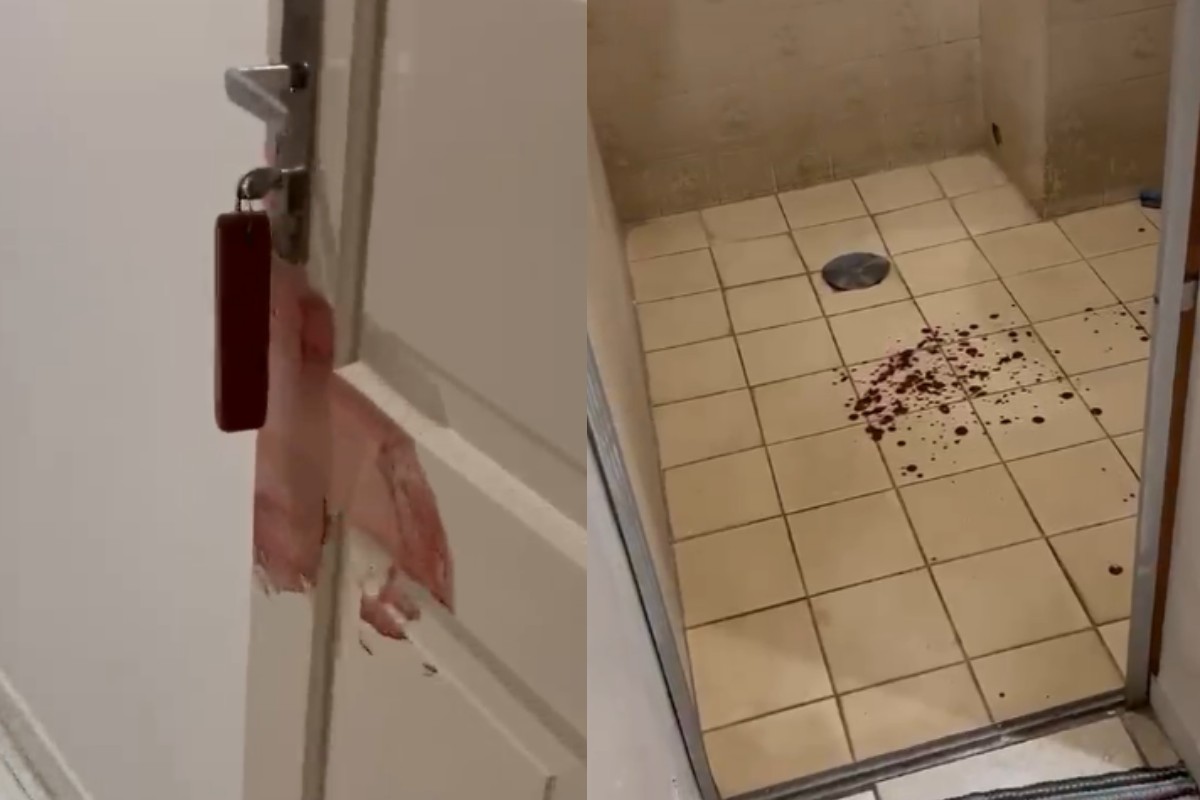 Funcionária de hotel é socorrida após ser agredida com cabo de vassoura por hóspede no interior de SP