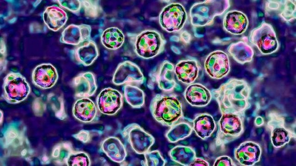 O vírus do sarampo é altamente contagioso: uma pessoa infectada pode transmitir o patógeno para outras 18 — Foto: Getty Images/BBC