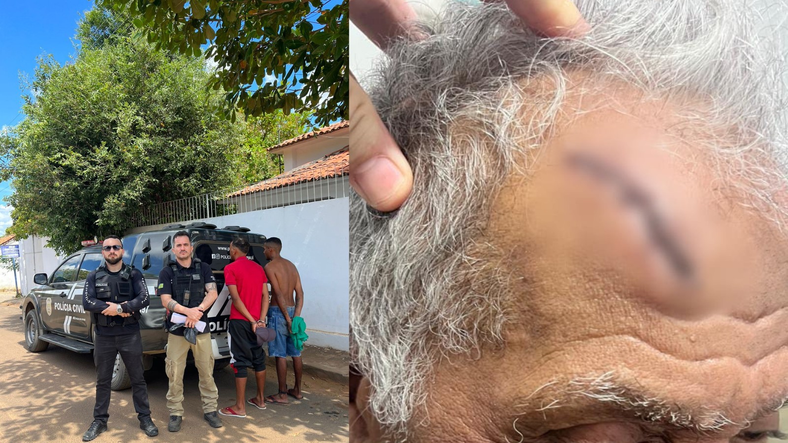 Suspeitos de agredir idoso de 80 anos durante assalto são presos em Angical do Piauí; vítima teve lesões graves 