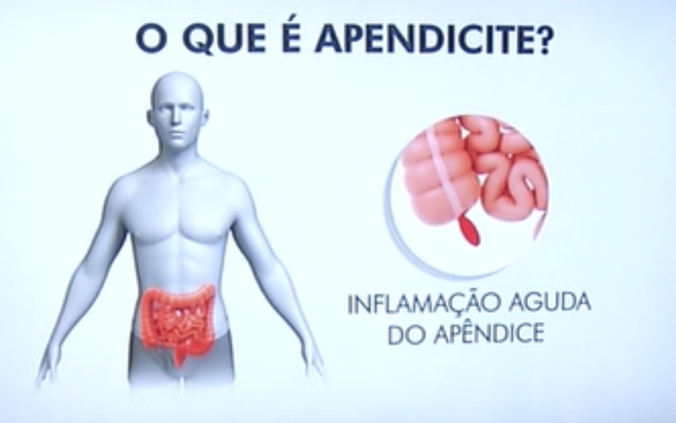  — Foto: Reprodução/TV Anhanguera