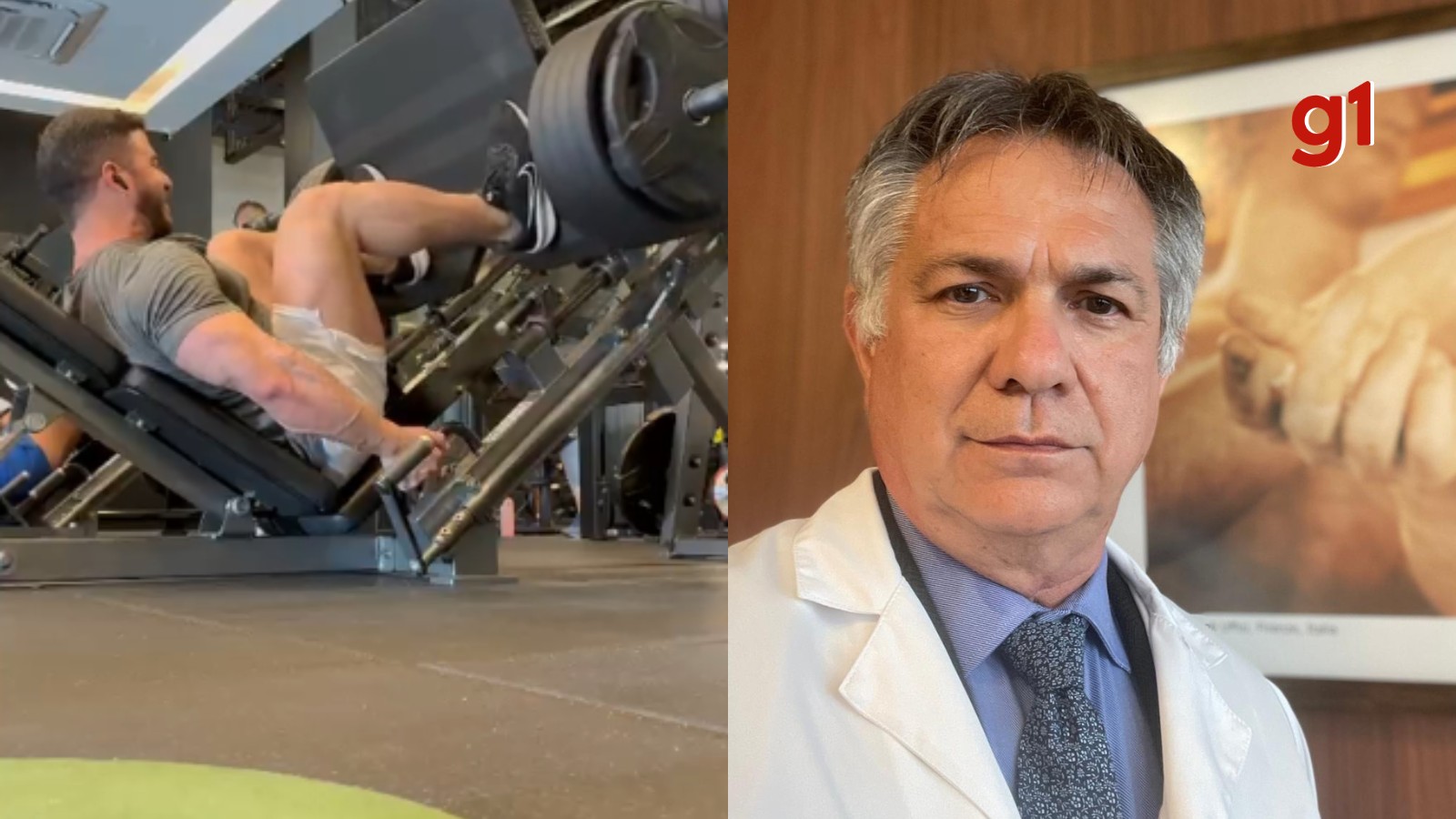 Fisiculturista rompe tendão em exercício com 400 kg e ortopedista alerta: 'aparelho pode ser traiçoeiro'