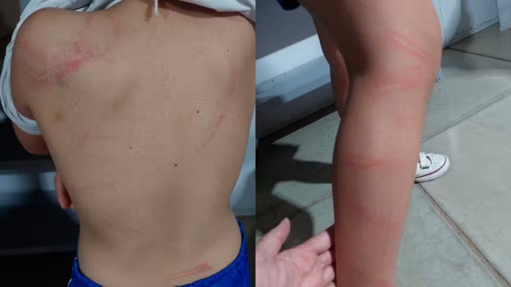 Mãe é presa por agredir a filha de 6 anos com mangueira por não conseguir fazer dever de casa