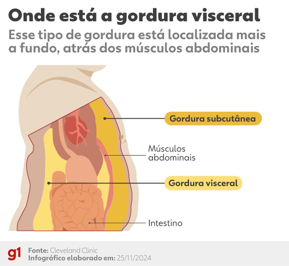 Onde está a gordura visceral — Foto: Arte/g1