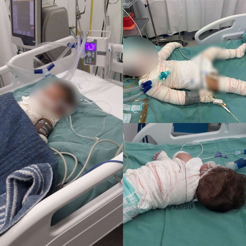 Mãe e filhos ficam em estado grave após churrasco explodir — Foto: Reprodução