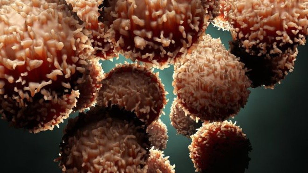 Células de câncer são células comuns que sofrem mutações e passam a se multiplicar sem controle — Foto: Getty Images via BBC
