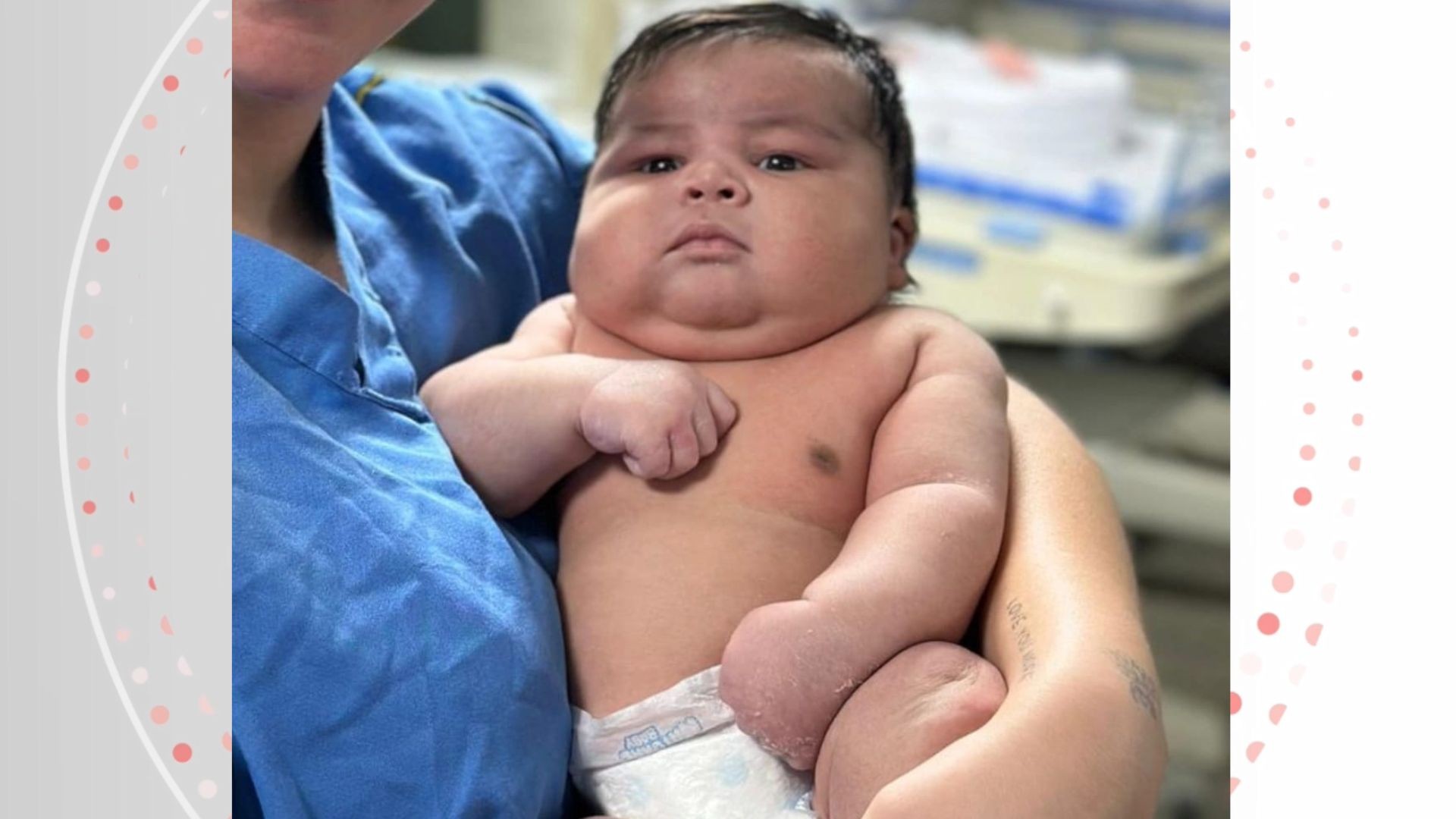 Bebê gigante nasce de parto normal pesando 6,5 kg no ES; mãe diz que criança perdeu movimento no braço