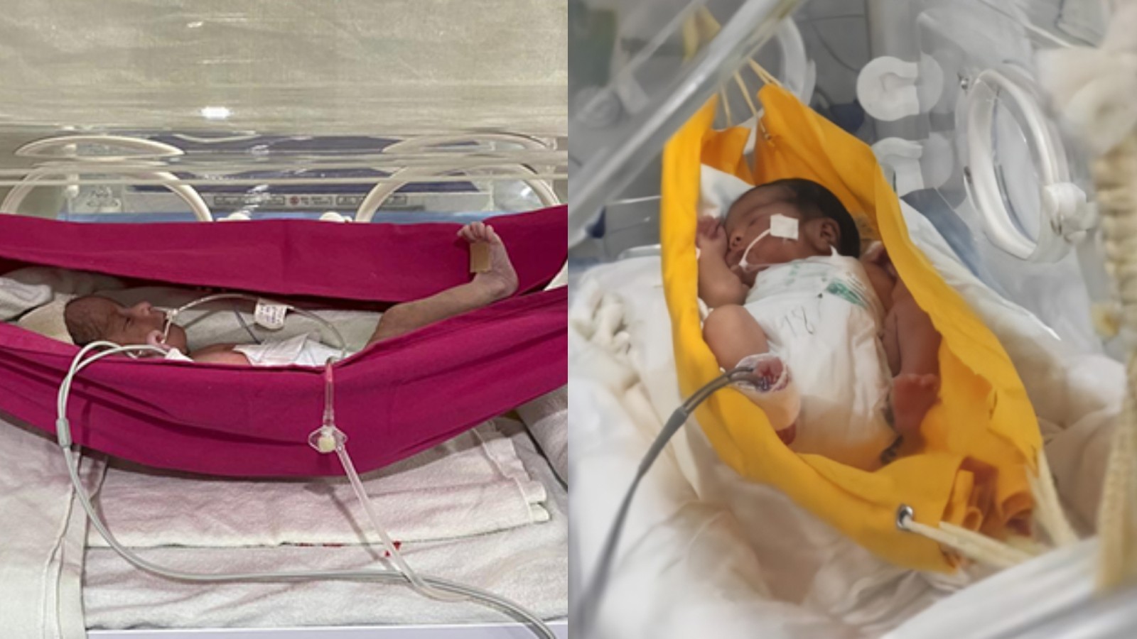 Dormir em rede ajuda no desenvolvimento de bebês prematuros, diz pesquisa