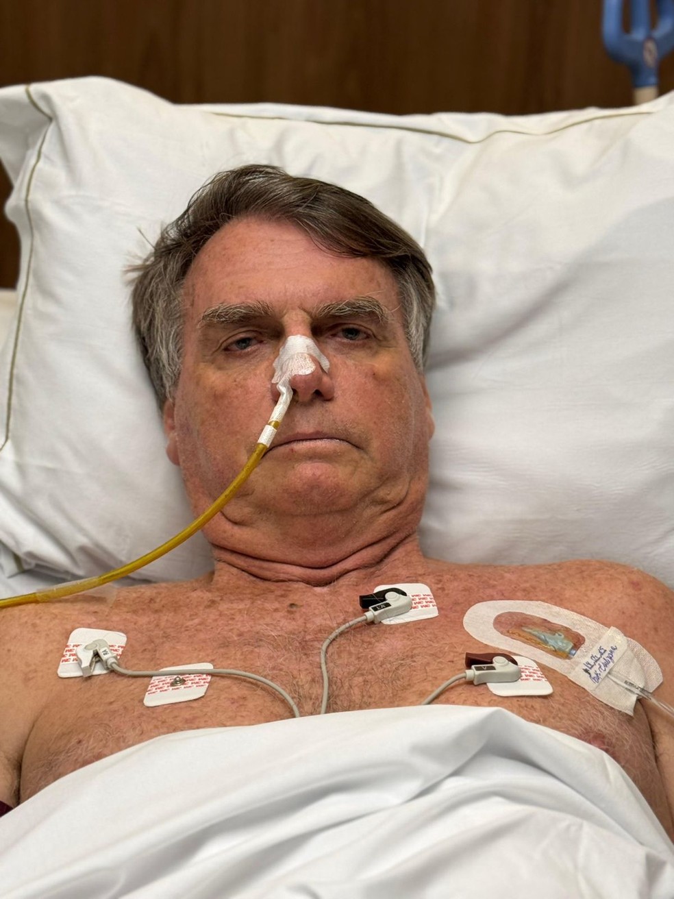 O ex-presidente Jair Bolsonaro no hospital no quinto dia após a cirurgia para desobstruir o intestino delgado — Foto: Reprodução/X