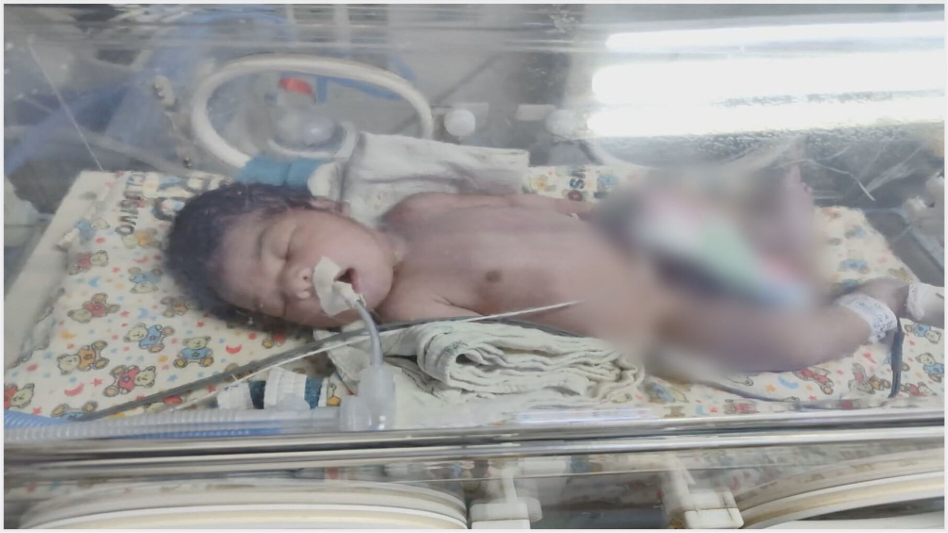 Jovem perde bebê após mais de 24h de parto induzido no Hospital de Ceilândia; polícia investiga