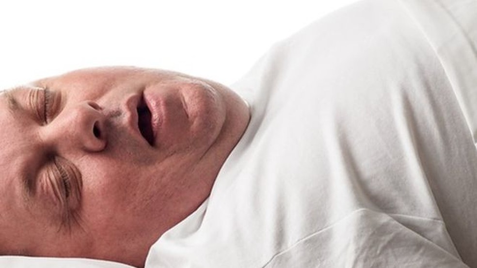 Apneia do sono: por que parar de respirar enquanto dorme é tão