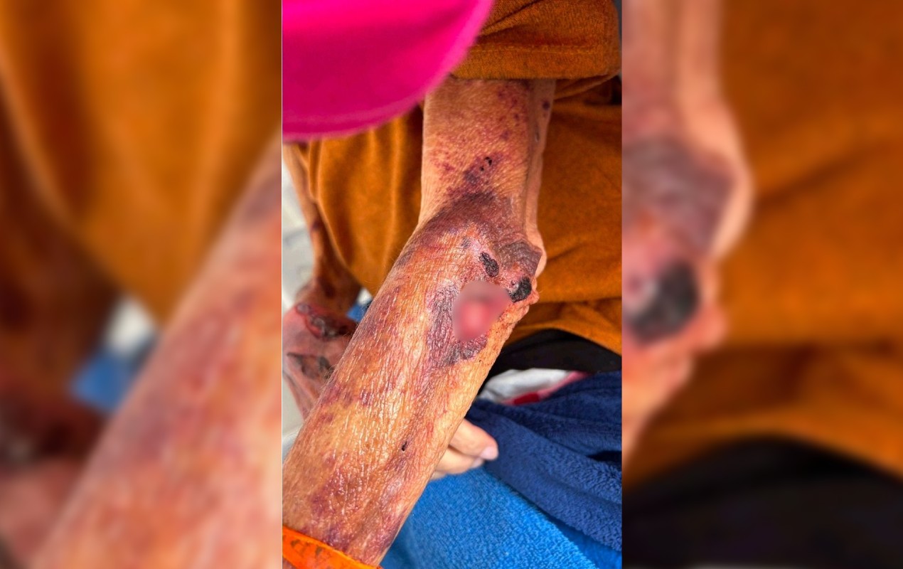 Mulher é presa suspeita de manter a mãe idosa em situação de desnutrição e maus-tratos no interior de SP 