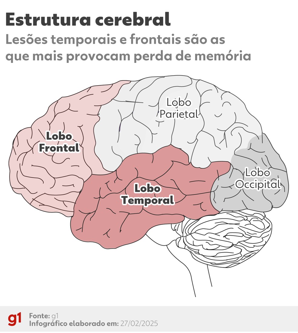 Entenda como é formada a estrutura cerebral — Foto: arte g1
