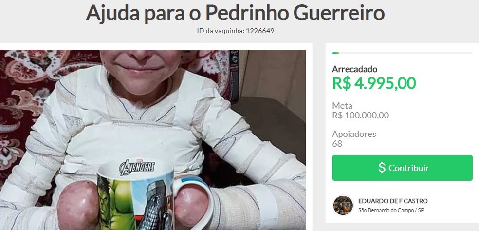 Família cria 'vakinha' online para custear tratamento de criança