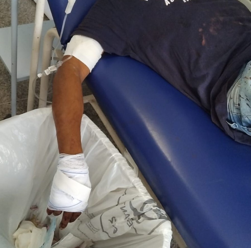 Homem tem mão baleada na zona Norte de Teresina — Foto: Polícia Militar do Piauí
