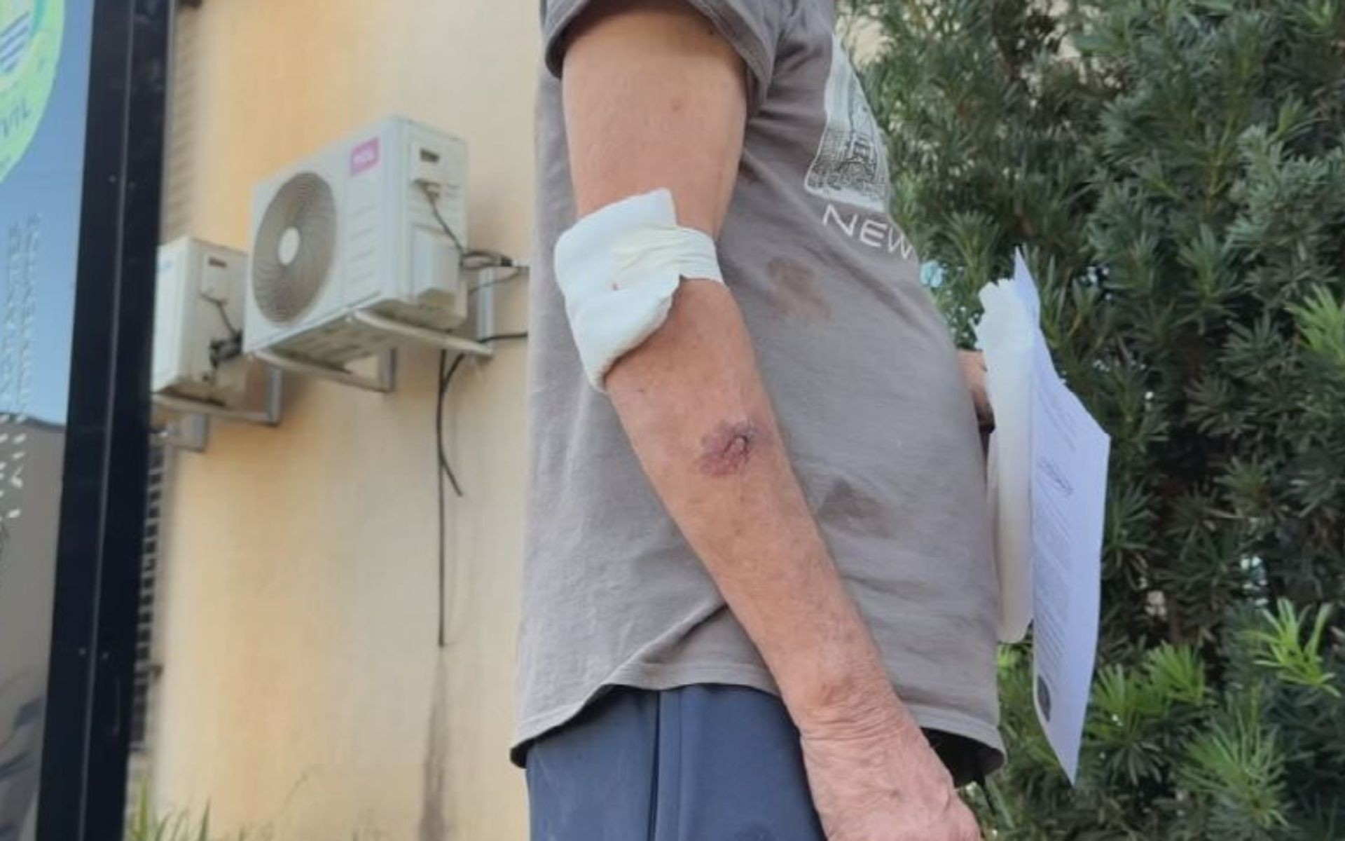 Idoso salvo por pitbull após ser agredido pelo filho cuida do animal todos os dias: 'Um herói', diz neto da vítima  