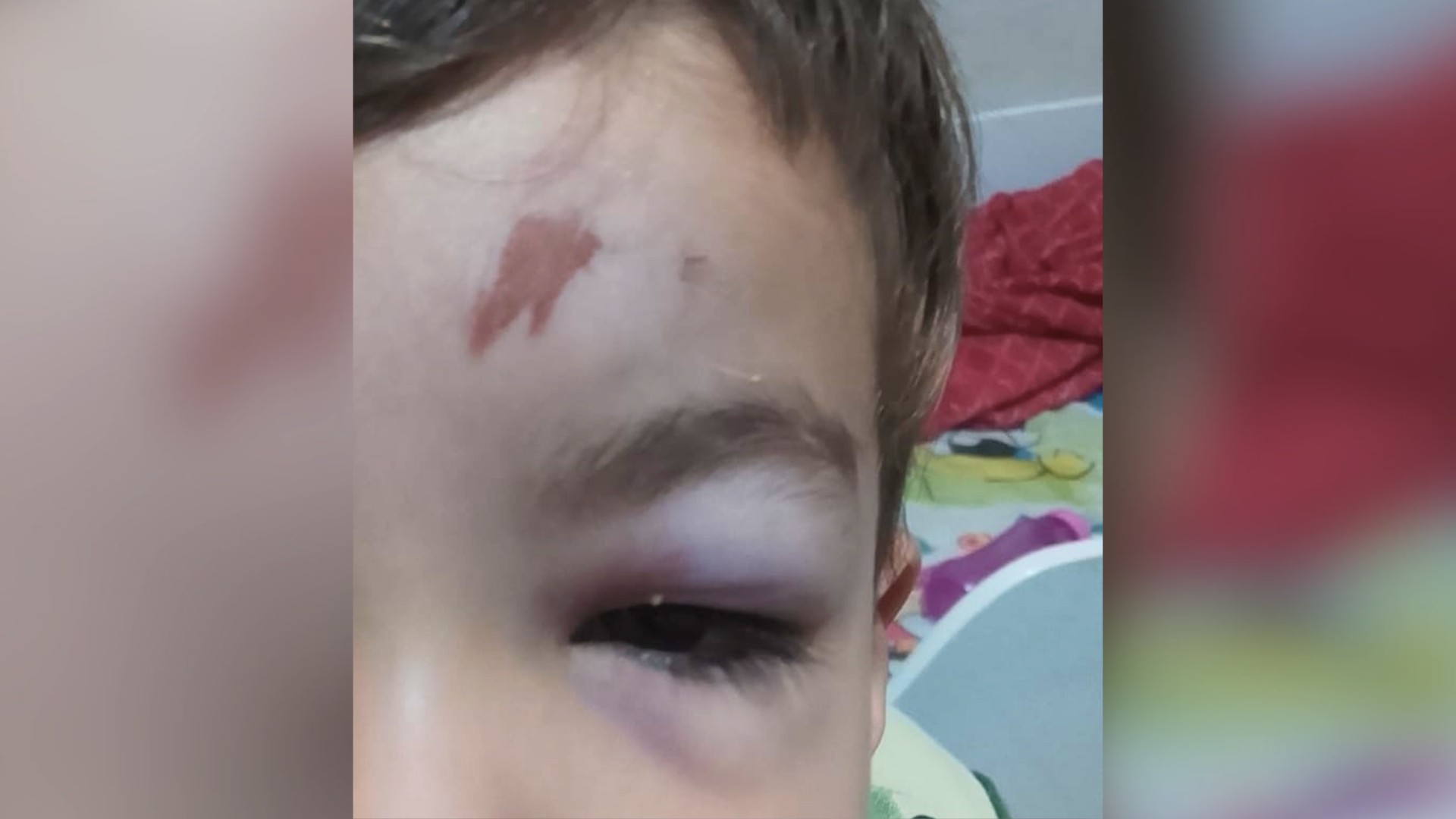 Mãe paga tomografia após criança bater a cabeça, vomitar e esperar quase 48 horas por vaga na Santa Casa  de Araçatuba