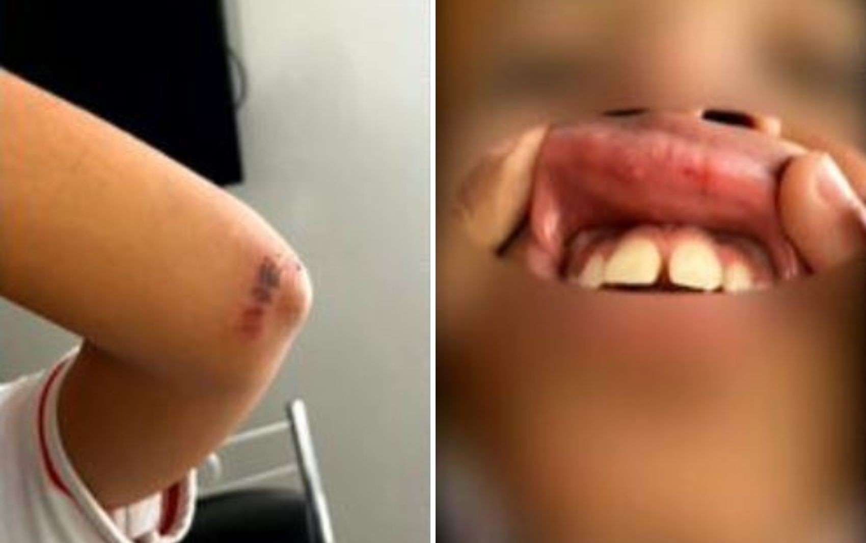 VÍDEO: Aluna leva socos e tem dente quebrado por colegas em escola de Goiânia, diz família