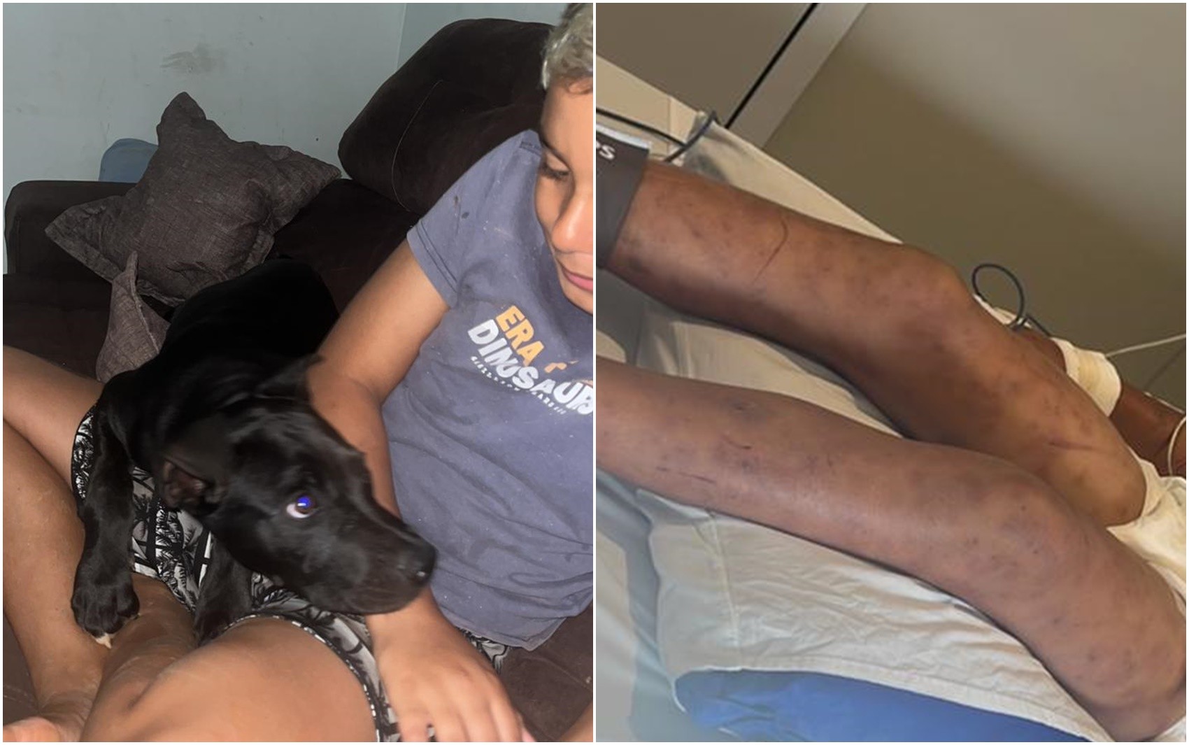 Menino picado por abelhas da cabeça aos pés entrou na mata para salvar cachorro de ataque, diz mãe 