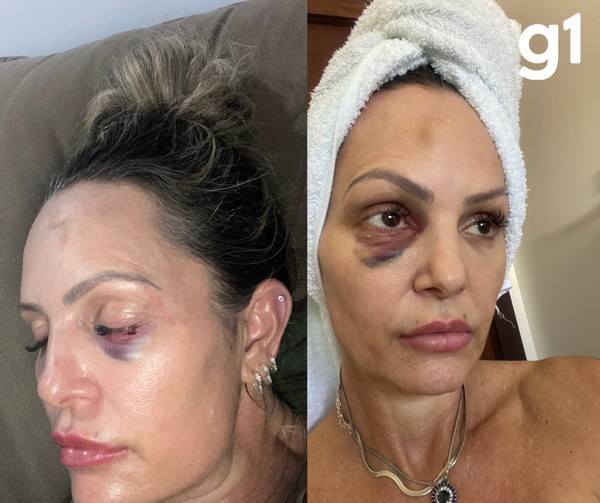 D&eacute;bora contou que relacionamento sempre foi marcado por viol&ecirc;ncias &mdash; Foto: Arquivo pessoal