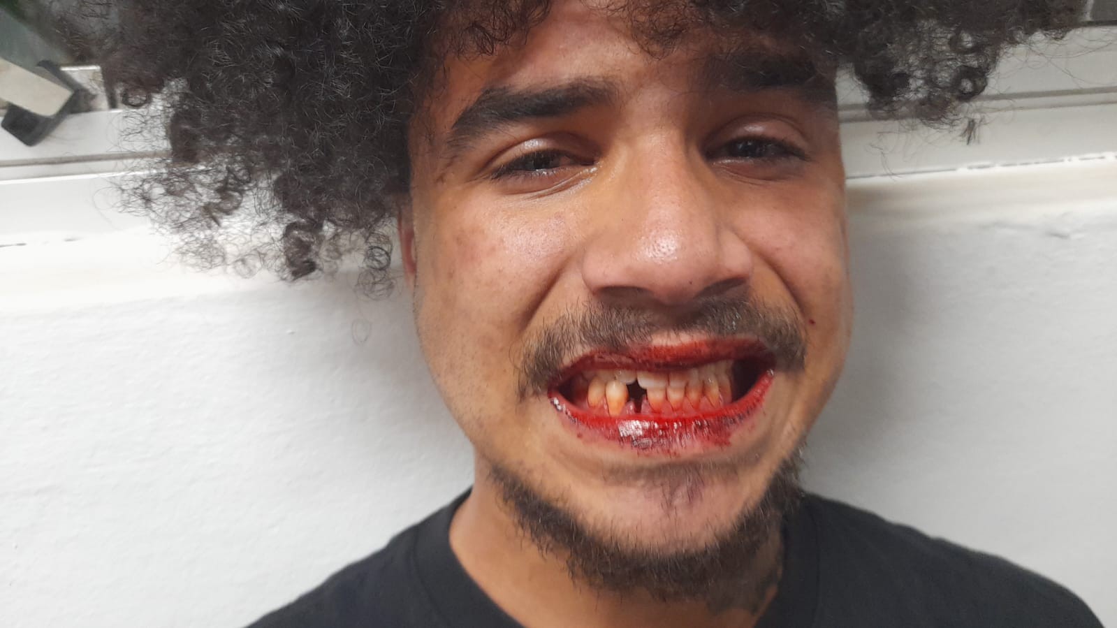 Jovem negro toma mata-leão de segurança após pular catraca da CPTM, perde dente e diz que mordeu segurança como defesa