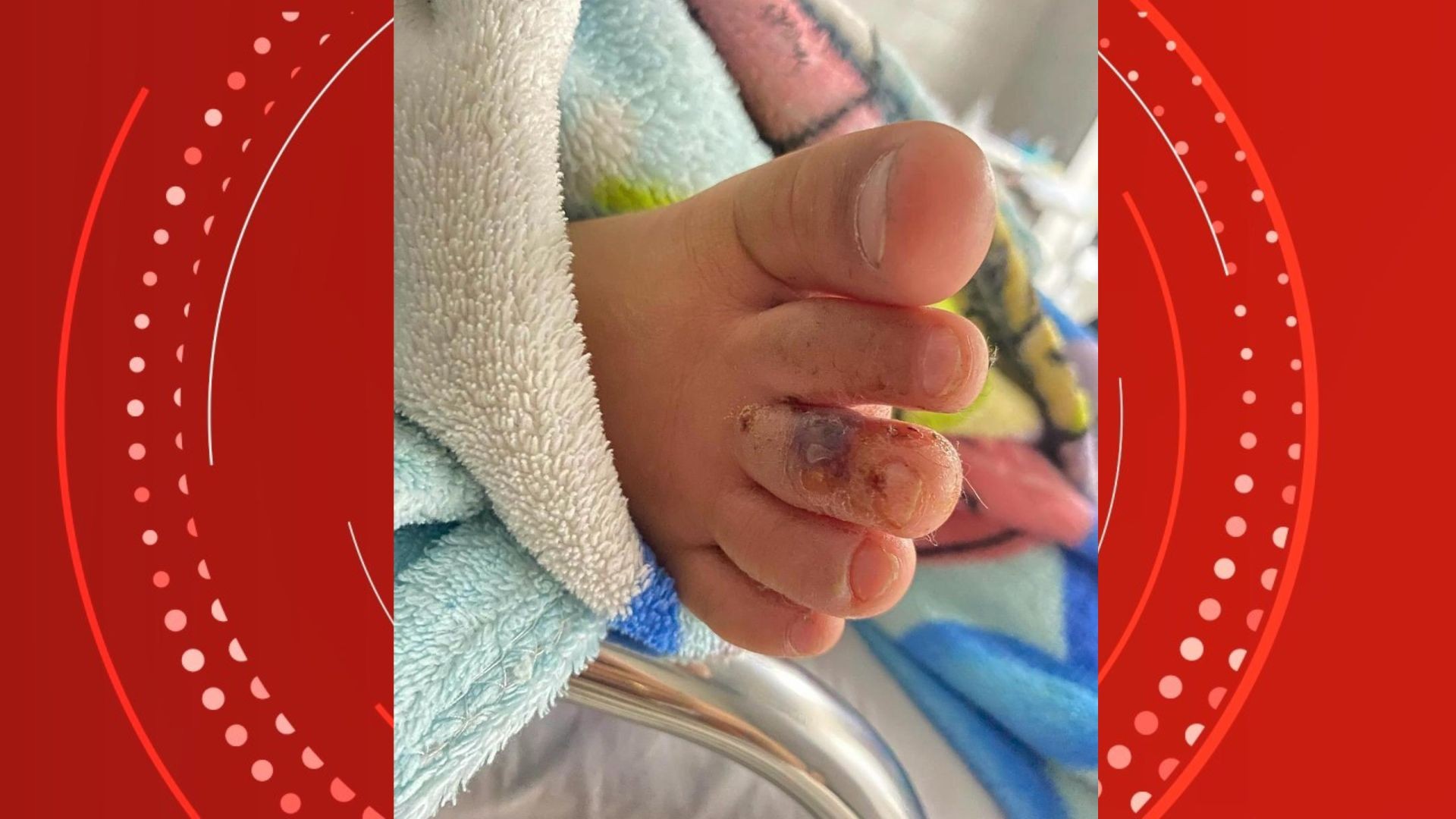 VÍDEO: Mãe relata que filho de 3 anos foi picado por cobra venenosa em creche, no ES 