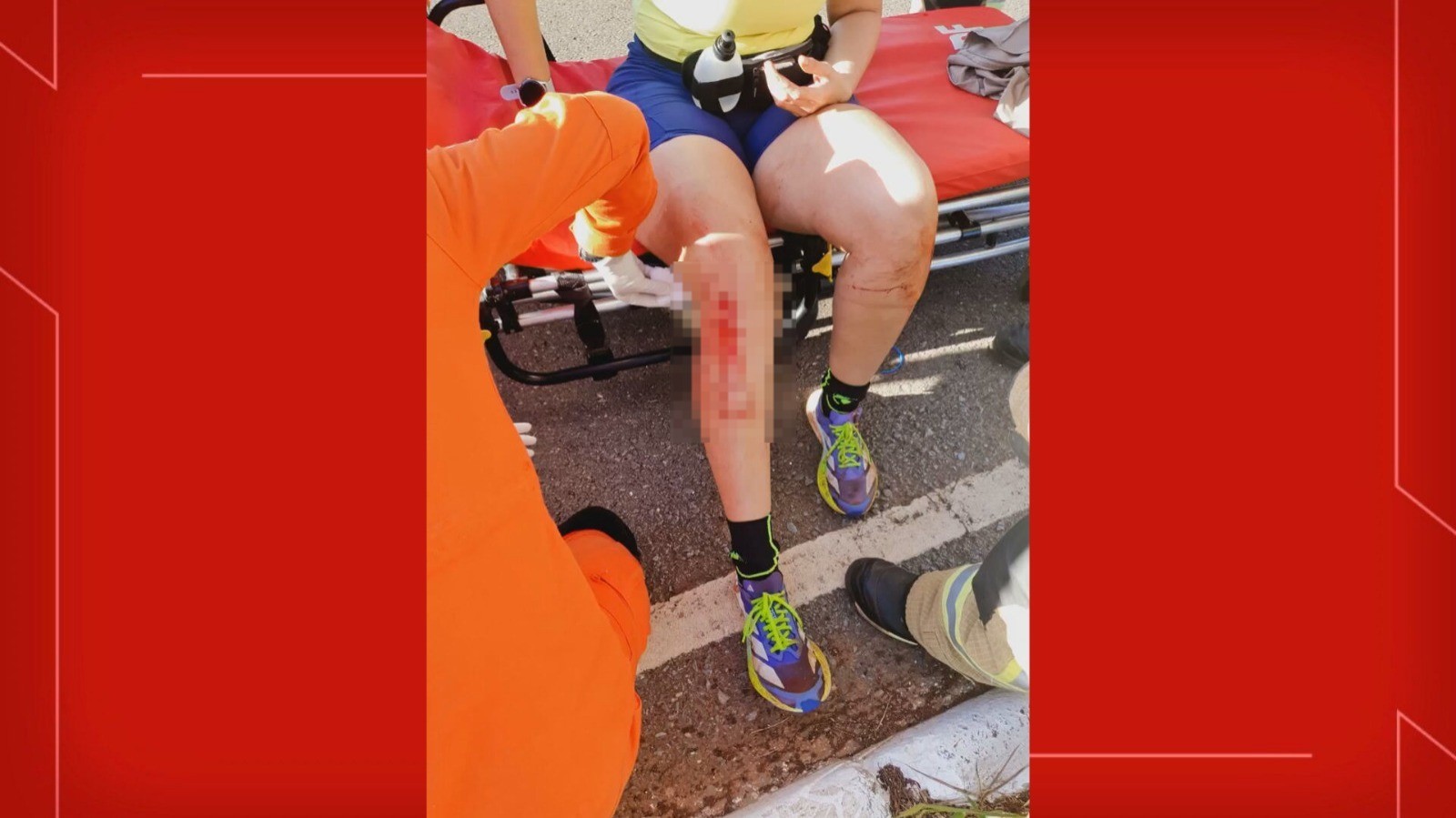 Mulher é atacada por matilha de cachorros durante corrida na Vila Planalto