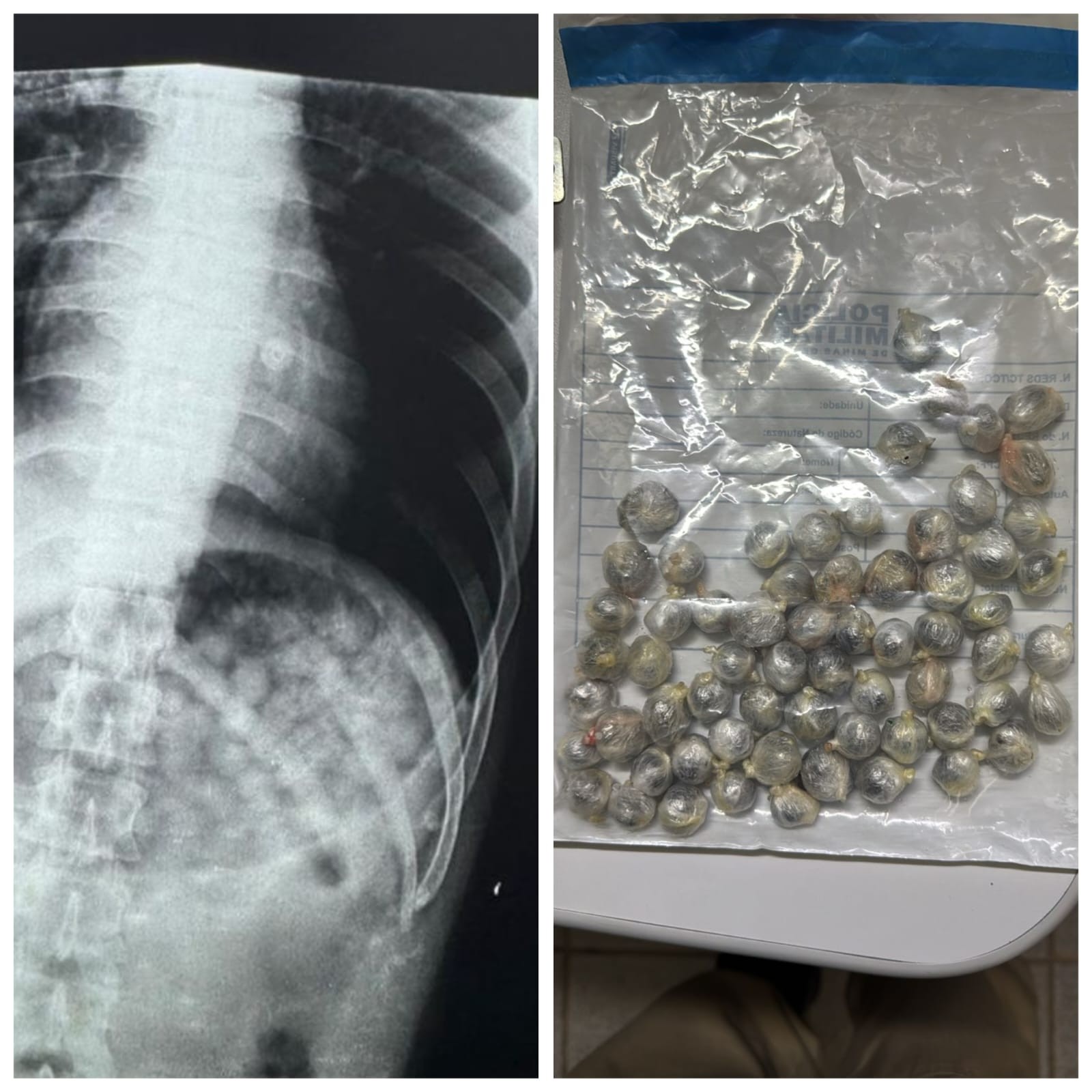 Detento em saída temporária passa mal após engolir 61 buchas de maconha em MG; suspeita é que ele tentava voltar ao presídio com a droga