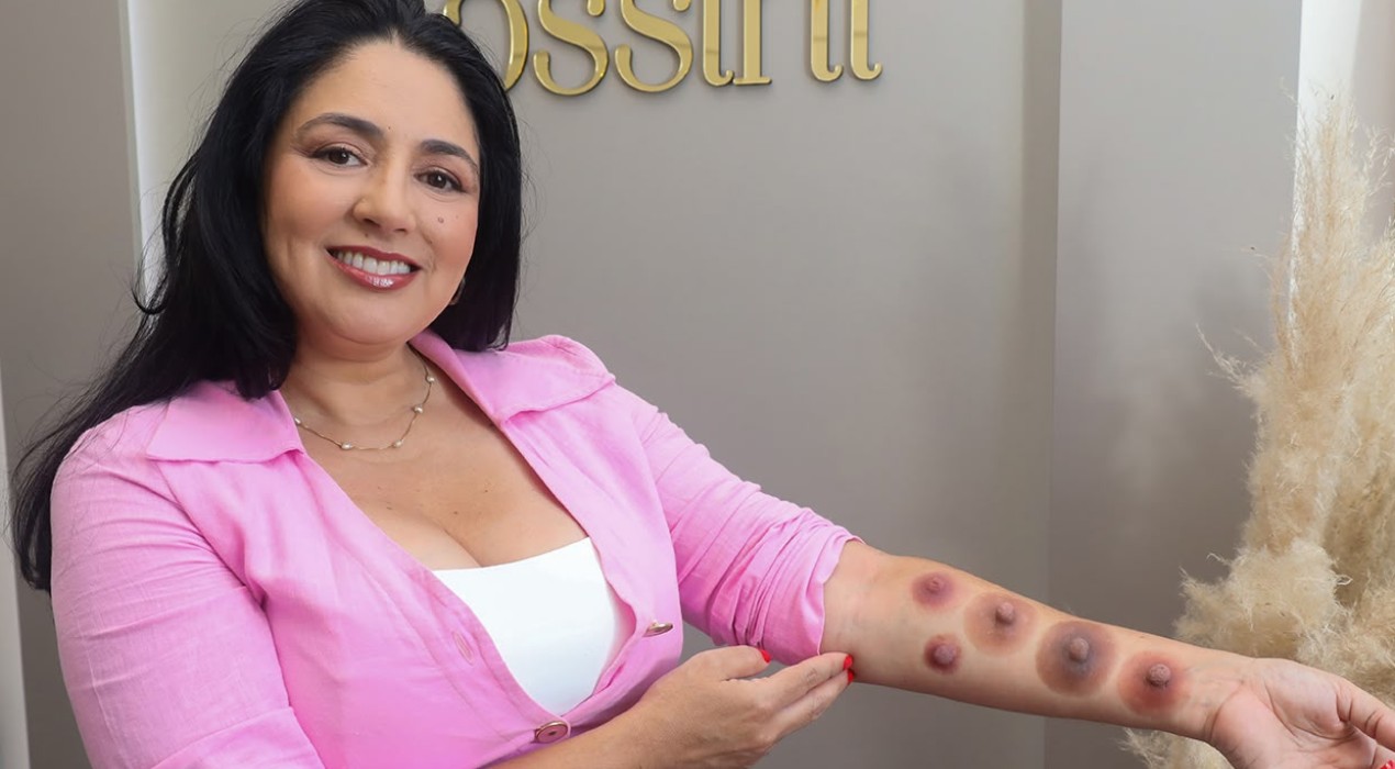 Outubro rosa: técnica em silicone reconstrói aréolas e resgata identidade de mulheres no interior de SP