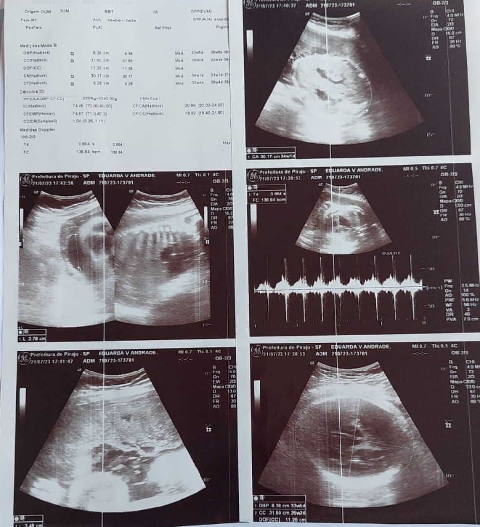 Ultrassom feito em Botucatu (SP) revelou aos médicos uma gravidez com mais de 34 semanas — Foto: Arquivo pessoal