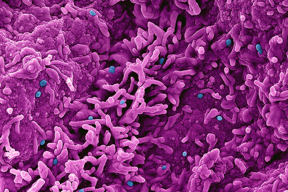 Partículas do vírus da mpox vistas em microscópio eletrônico. — Foto: NIAID