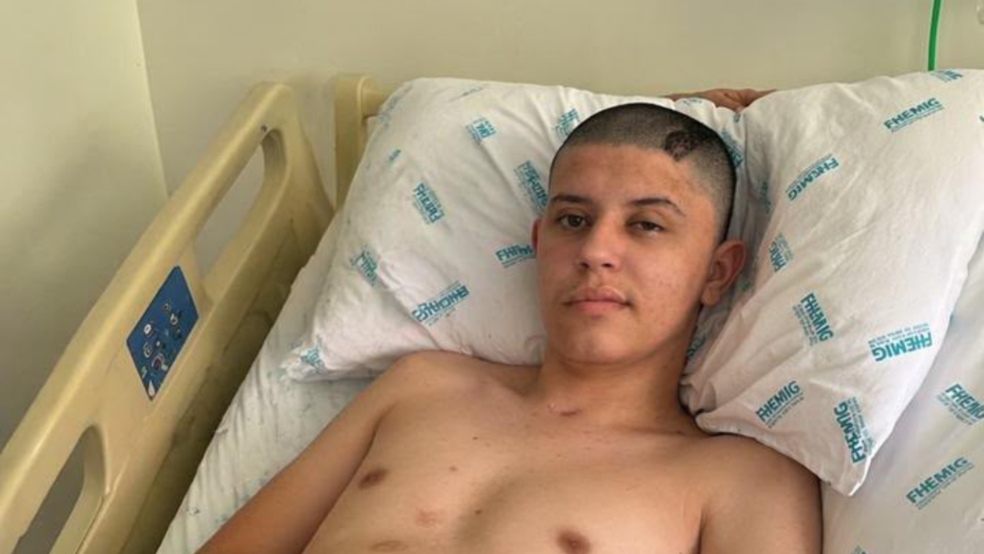 Jovem que ficou tetraplégico ao ser atingido por bala perdida morre após mais de um ano de tratamento