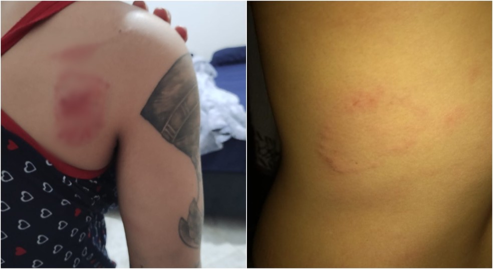 Mulher estava com marcas de socos em mordidas pelo corpo em Avaré (SP) — Foto: Arquivo pessoal