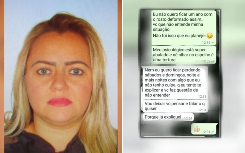 Enfermeira Marcilane da Silva Espíndola, investigada após pacientes ficarem com rostos deformados depois de procedimentos estéticos, Goiás — Foto: Divulgação/Polícia Civil