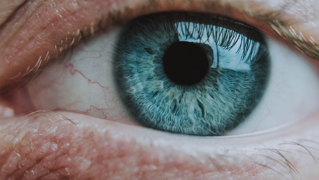 Fotofobia: por que o problema é mais comum em pessoas com olhos claros? -  Signorelli Oftalmologia