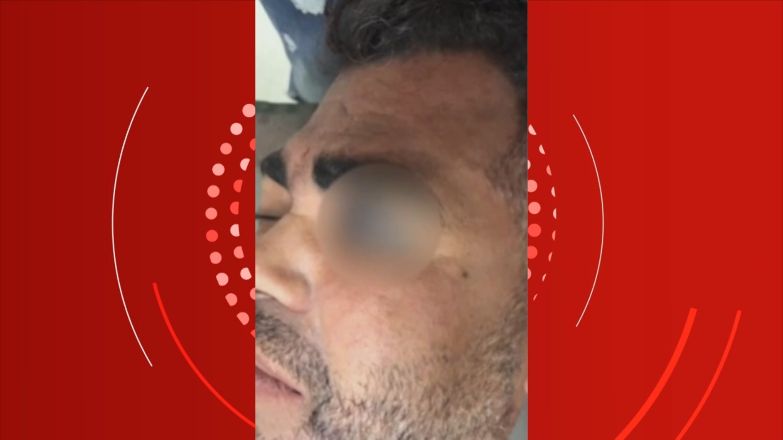 Guardas municipais são suspeitos de agredir homem com pedaço de madeira no sudoeste da Bahia